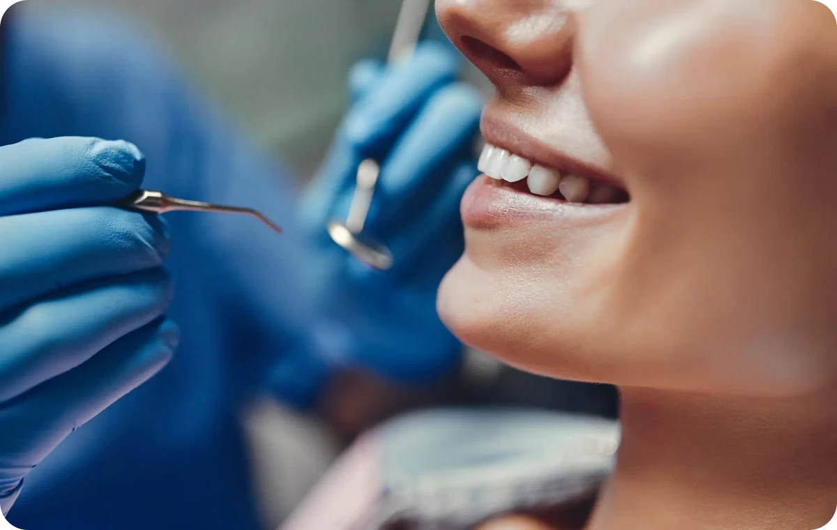 Chirurgie plastique parodontale Cabinet OPÉRA, Chirurgiens-dentistes à Lille