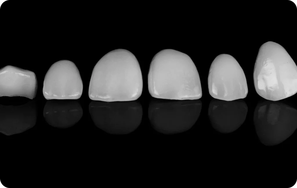 Facettes dentaires Cabinet OPÉRA, Chirurgiens-dentistes à Lille